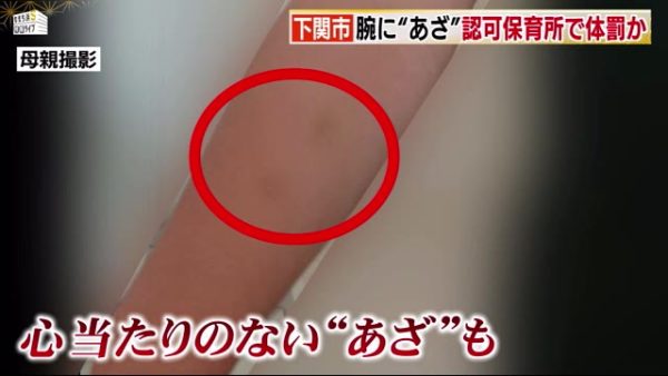 保育士 暴力