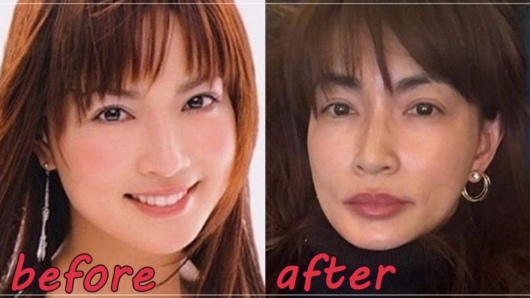 比較画像 長谷川京子 唇おばけ いつから 若い頃と顔変化を調査