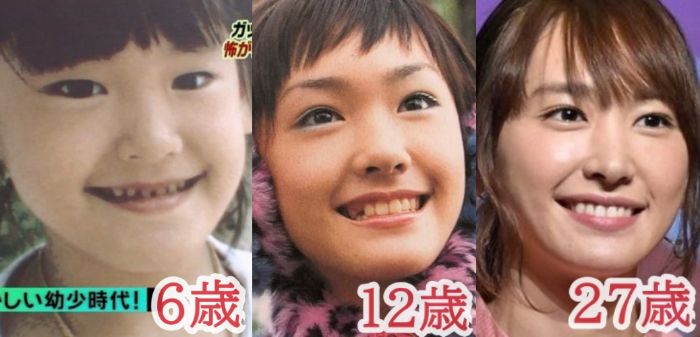 画像28枚 新垣結衣が昔の顔と違う 整形した 若い頃からの変化を検証 Sunとらのすけ